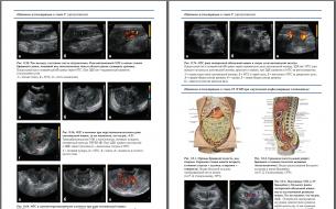 Tıbbi yayınların, yayıncıların, dizilerin yayınlanma özellikleri Tıp kitaplarında görsel materyal